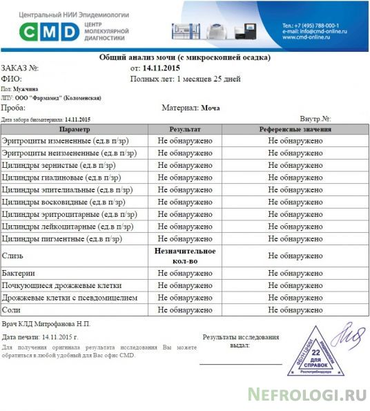 Смд анализ мочи