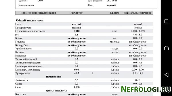 Сдача мазок у мужчин. Урологический мазок на степень чистоты. Урологический мазок у мужчин. Эритроциты в мазке из уретры у мужчин. Код эритроцитов в анализе мазка.